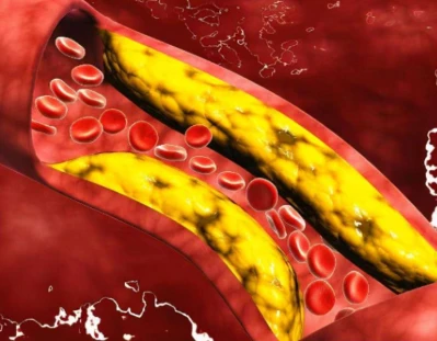 Bioglutide Online | Shaanxi BLOOM Tech Co., Ltd Bioglutide Online | Shaanxi BLOOM Tech Co., Ltd